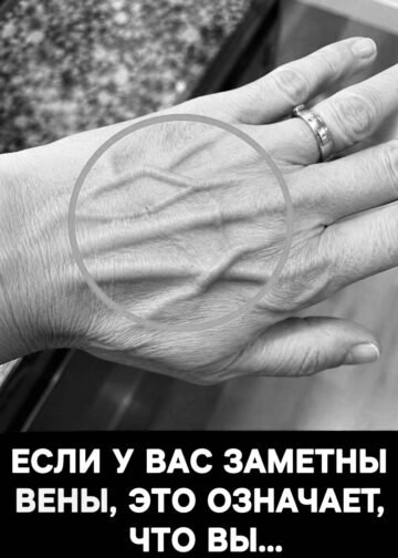 ЕСЛИ У ВАС ЗАМЕТНЫ ВЕНЫ, ЭТО