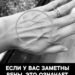 ЕСЛИ У ВАС ЗАМЕТНЫ ВЕНЫ, ЭТО