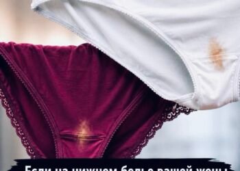 ЗНАЮТ ЕДИНИЦЫ! Если на нижнем белье